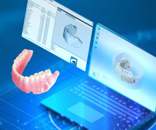 Dental CAD/CAM Software